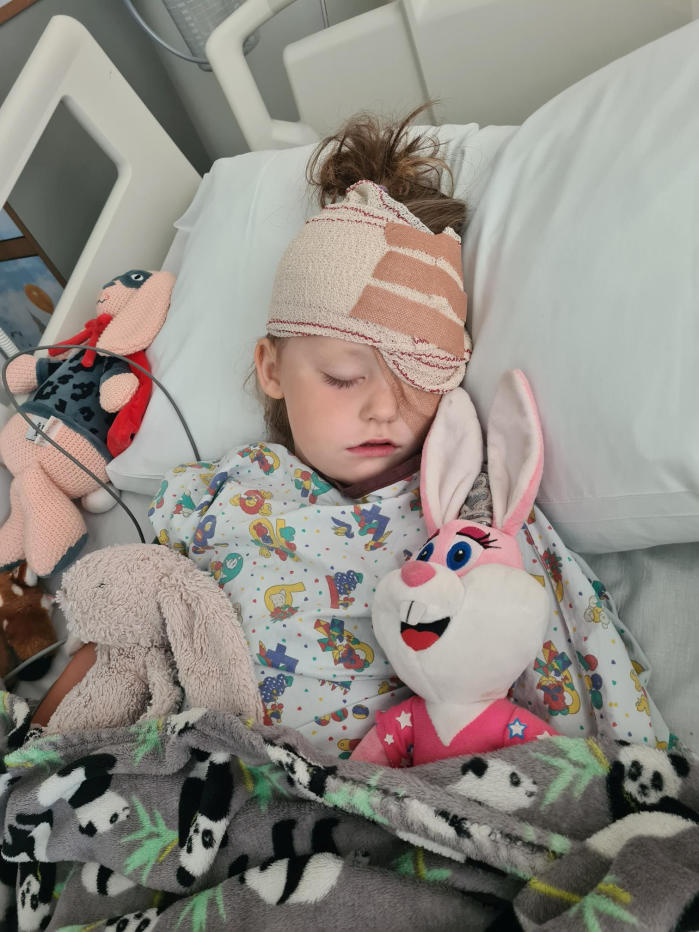 Darcey-Rose Hickson after having eye removed. (Childhood Eye Cancer Trust/SWNS)