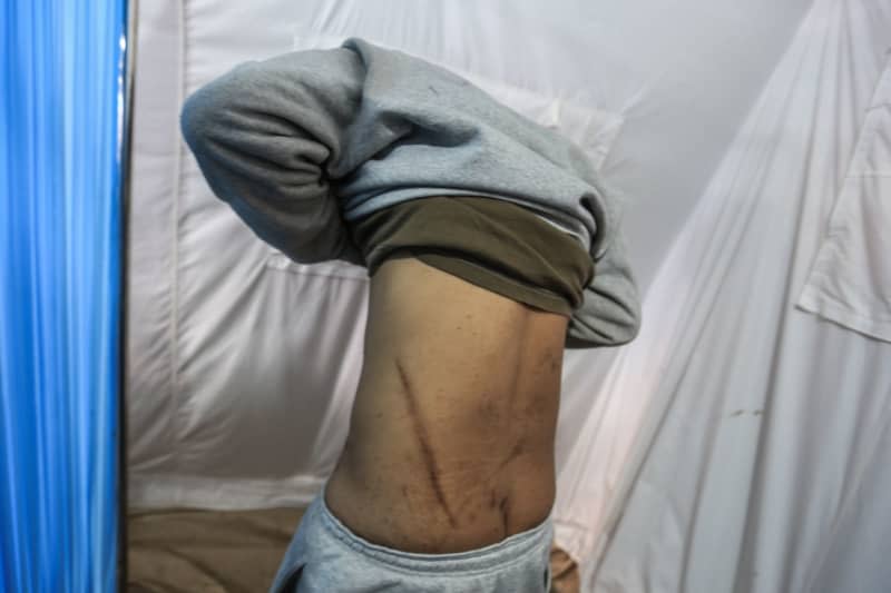 A Palestinian man, who was released after being detained with other civilians for questioning by Israeli forces amid the ongoing conflict between Israel and the Palestinian Hamas militant group, shows his wounds while waiting at Al-Najjar Hospital in Rafah. Mohammed Talatene/dpa