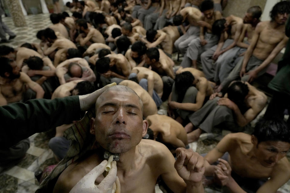 A drug addict detained during a Taliban raid is shaved at a drug treatment camp in Kabul, Afghanistan, Tuesday, May 31, 2022. Drug addiction has long been a problem in Afghanistan, the world’s biggest producer of opium and heroin. The ranks of the addicted have been fueled by persistent poverty and by decades of war that left few families unscarred. (AP Photo/Ebrahim Noroozi)