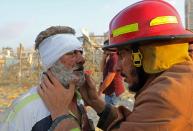 A wounded man is checked by a fireman near the scene of an explosion in Beirut on August 4, 2020. - A large explosion rocked the Lebanese capital Beirut on August 4, an AFP correspondent said. The blast, which rattled entire buildings and broke glass, was felt in several parts of the city. (Photo by Anwar AMRO / AFP) (Photo by ANWAR AMRO/AFP via Getty Images)