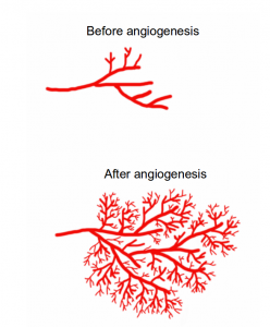 The Hallmarks of Cancer 5: Sustained Angiogenesis