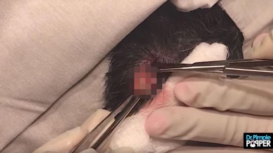 Watch the video above for the uncensored version... but only if you've got a strong stomach. Photo: Youtube/Dr Sandra Lee