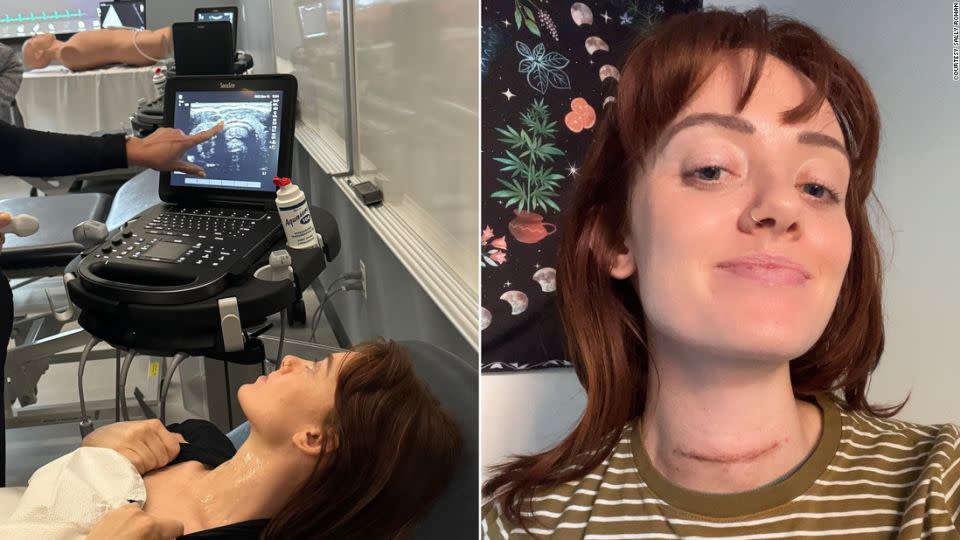 In the photo of the left, Sally Rohan views her thyroid ultrasound. The image on the right shows her surgical scar after her thyroid was removed. - Courtesy Sally Rohan