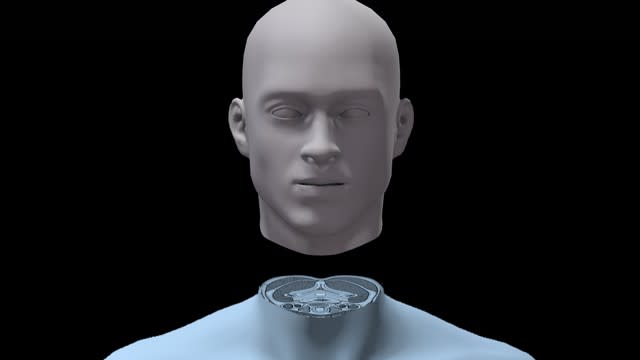 Neurosurgeon Sergio Canavero wants to perform the first human head transplant