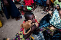 <p>A boy holds his teddy bear as he waits with other Internally Displaced Persons (IDP) for a daily food ration at a camp for IDP’s fleeing the conflict in the Kasai Province on June 7, 2017 in Kikwit, Democratic Republic of Congo. (Photo: John Wessel/AFP/Getty Images) </p>