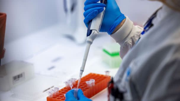 PHOTO: Microbiologists with the AEGIS Sciences Corporation process Covid-19 and Monkeypox tests at its facility in Nashville, Tenn., Aug. 4, 2022.  (Anadolu Agency via Getty Images)