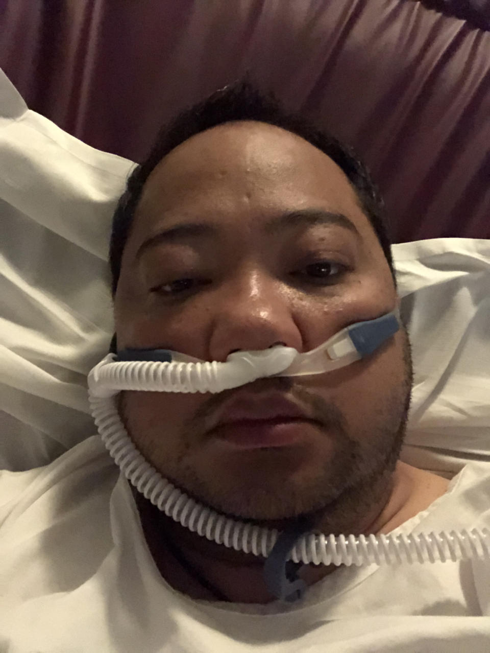 Pictured is Michael Rojales in a hospital bed with tubes hooked to his nose.