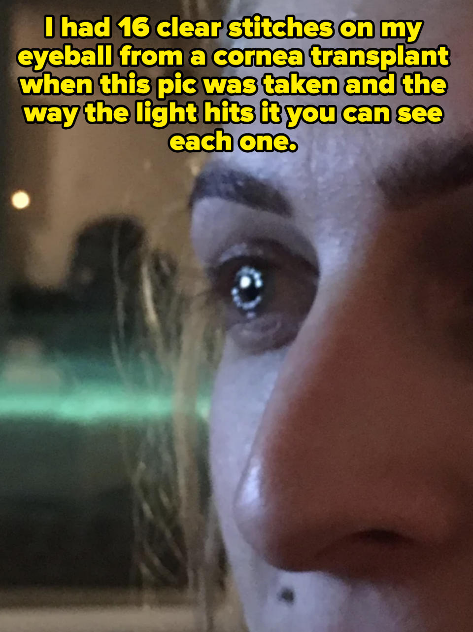 Close-up of a person's eye and part of their nose, with a reflection of light visible in the eye