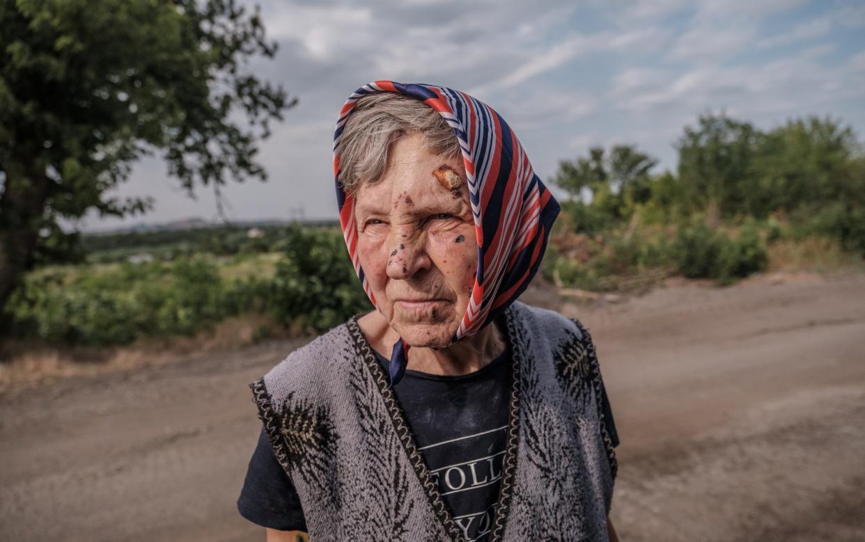 Alina, 72, is waiting to be evacuated after being injured by russian airstrikes at her house in Kurakhove, Donetsk, where Russian troops get closer everyday
