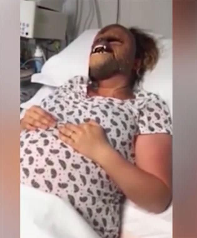 Aimee Smith wears a Chewbacca mask during labour. Photo: SWNS
