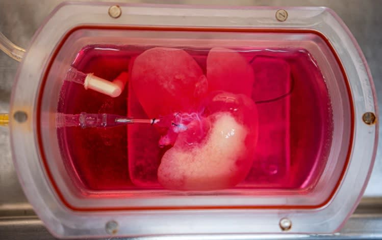Mini hígado derivado de células cutáneas humanas cultivado en un bioreactor. (Crédito imagen Universidad de Pittsburgh).