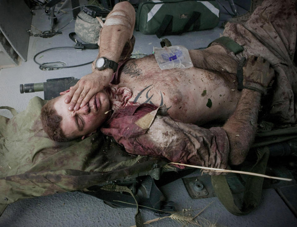 FILE - Injured U.S. Marine Cpl. Burness Britt reacts after being lifted onto a medevac helicopter from the U.S. Army's Task Force Lift "Dust Off," Charlie Company 1-214 Aviation Regiment on Saturday, June 4, 2011. Britt was wounded in an IED strike near Sangin, in the Helmand Province of southern Afghanistan. During his first operation in Afghanistan he suffered a stroke and became partially paralyzed. (AP Photo/Anja Niedringhaus, File)