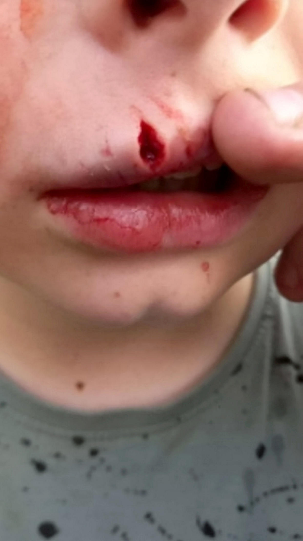 Police are appealing for information after a nine-year-old boy was bitten by a dog in Stoke-on-Trent, Staffs.  See SWNS story SWMDbite.  At approximately 5:45pm on Wednesday 20 April, a boy was bitten on the face by a dog on Belgrave Road, Dresden, at the rear of Belgrave St. Bartholomew’s Academy.  He suffered facial injuries and was transported to hospital for treatment.  Police are conducting enquiries locally and would like to speak to the owner of a large brown/ginger coloured Staffordshire Bull Terrier.  The suspected owner of the dog is described as white woman, roughly 5ft 6in tall, aged late 30s to early 40s and of a slim build with light brown shoulder length hair. She was wearing sunglasses on her head at the time of the incident. 