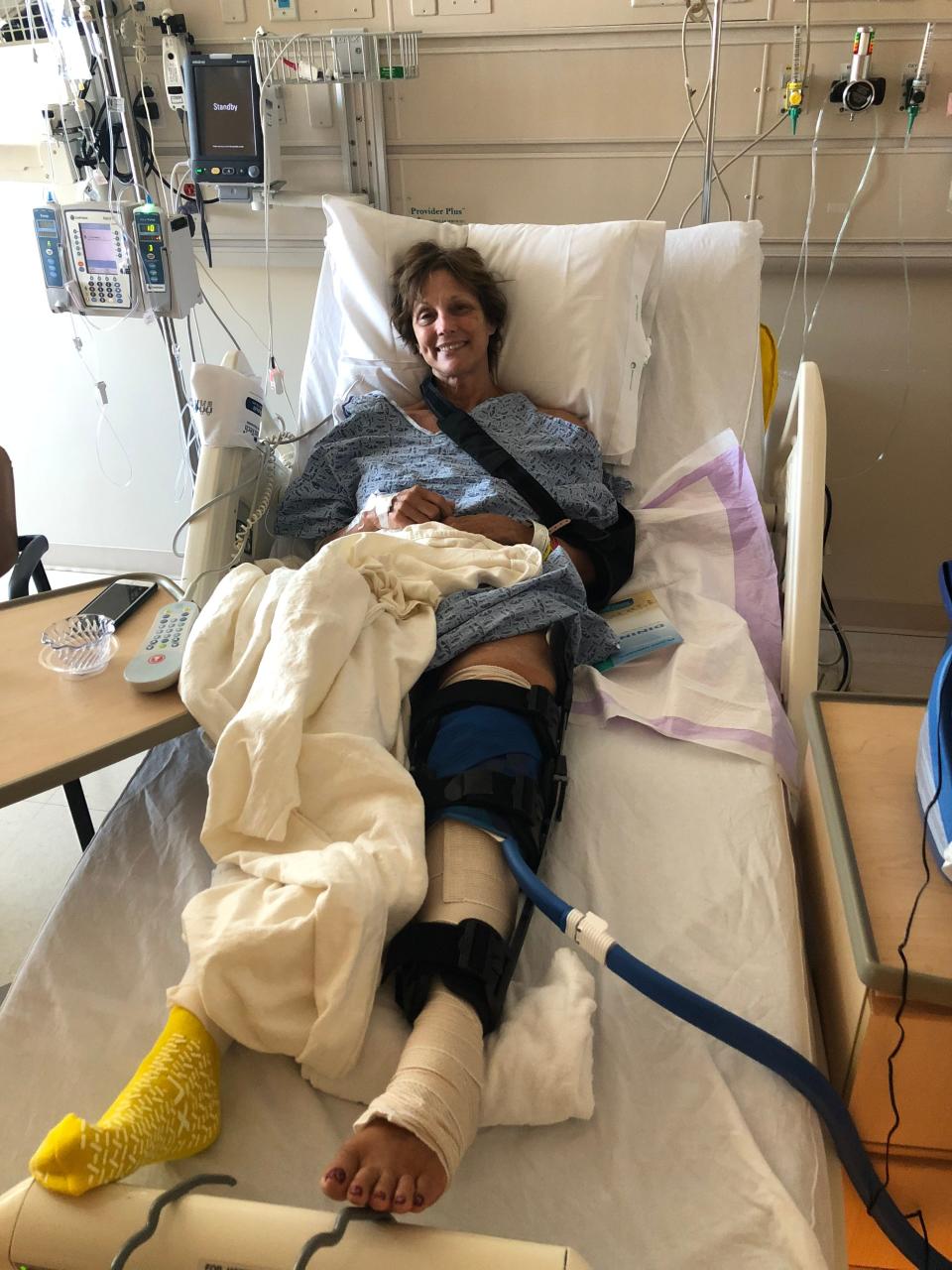 Fran Anderson, 81, is pictured recovering from a broken shoulder and broken knee sustained in a fall from a table in October 2018. Anderson didn't let the setback stop her from reaching Machu Picchu in Peru three months later.