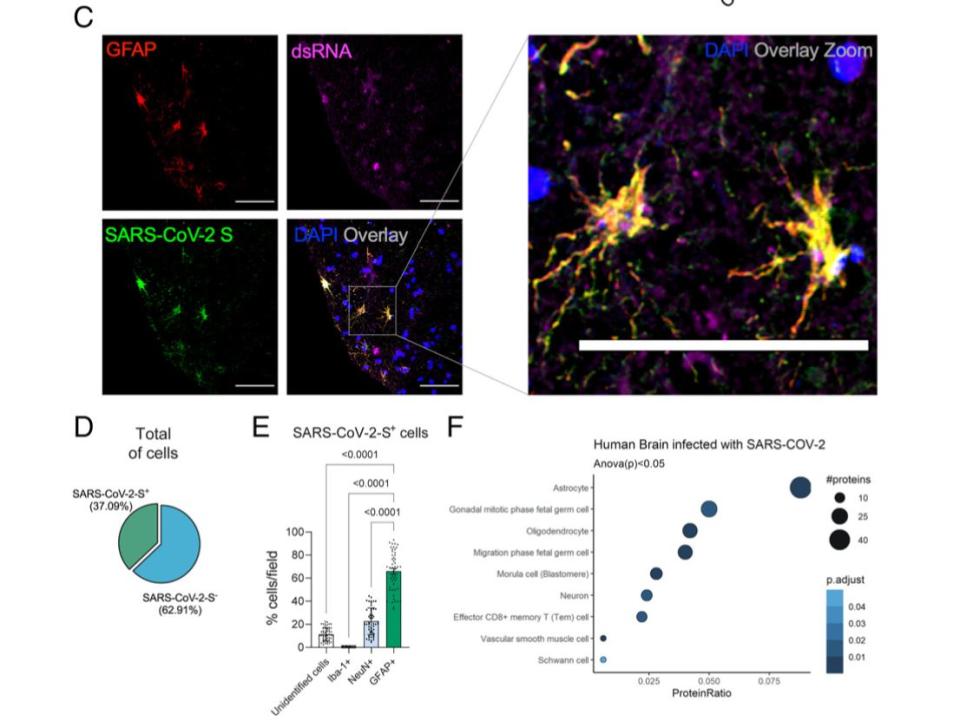 Infección de SARS-CoV-2 y replicación en astrocitos causando daño cerebral | Crunfli et al. PNAS