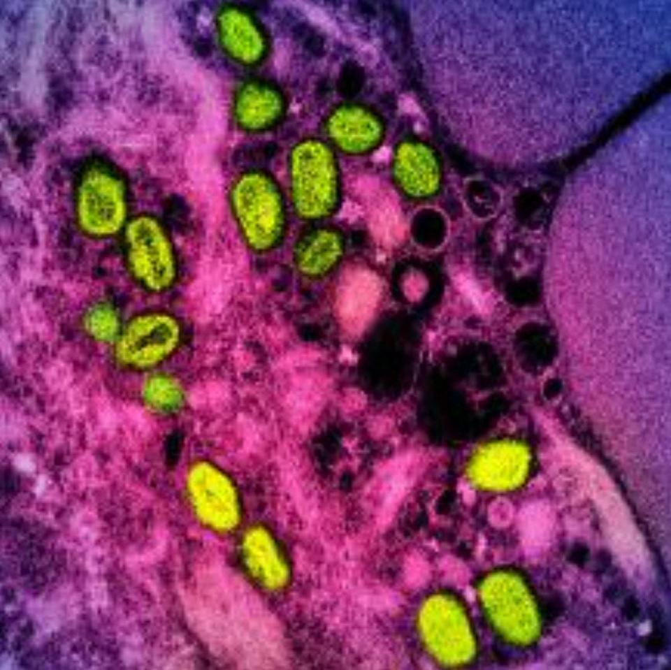 This undated image obtained from the National Institute of Allergy and Infectious Diseases (NIAID) in Bethesda, Maryland, shows a colorized transmission electron micrograph of monkeypox particles (green) found within an infected cell (pink and purple) cultured in the laboratory. - US health authorities announced on Thurday, Sept. 8, 2022, that they would carry out a clinical trial to test different dosing strategies of the Jynneos monkeypox vaccine amid uncertainty over its effectiveness. The trial will enroll 200 adults aged 18-50 across the country and is sponsored by NIAID. The Jynneos vaccine, manufactured by Denmark-based Bavarian Nordic, has been approved by the US to prevent smallpox and monkeypox in people aged 18 and older.