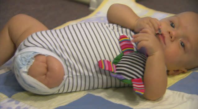 Sebastian's parents insist the loss of a limb will not stop him from living life to the full. Photo: 7News