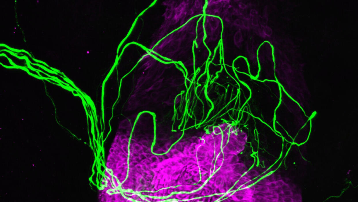  A bright green squiggle of nerves shown near a hair follicle, depicted as a dense, bright purple structure. 