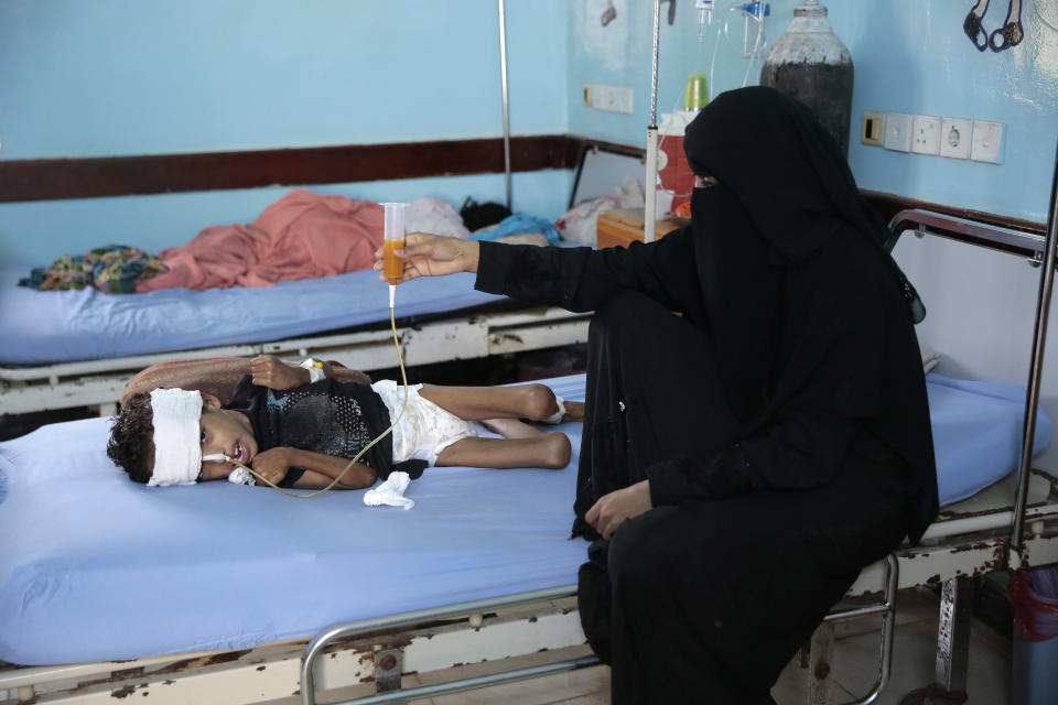 In this Thursday, Sept. 27, 2018 photo, a mother holds up a feeding tube for her malnourished son at a feeding center in a hospital in Hodeida, Yemen. With US backing, the United Arab Emirates and its Yemeni allies have restarted their all-out assault on Yemen’s port city of Hodeida, aiming to wrest it from rebel hands. Victory here could be a turning point in the 3-year-old civil war, but it could also push the country into outright famine. Already, the fighting has been a catastrophe for civilians on the Red Sea coast. (AP Photo/Hani Mohammed)