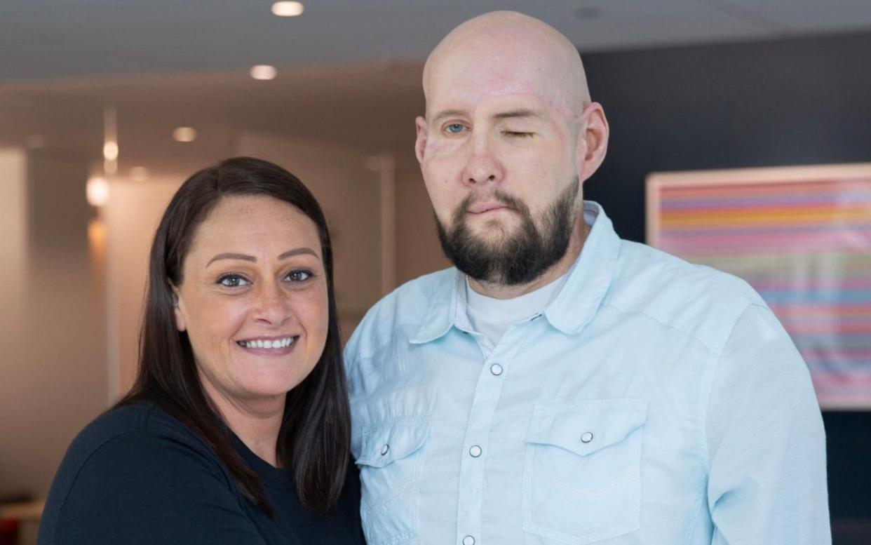 Aaron James, pictured with his wife, Meagan, says he is "back to being a normal guy, doing normal things" a year after the transplant