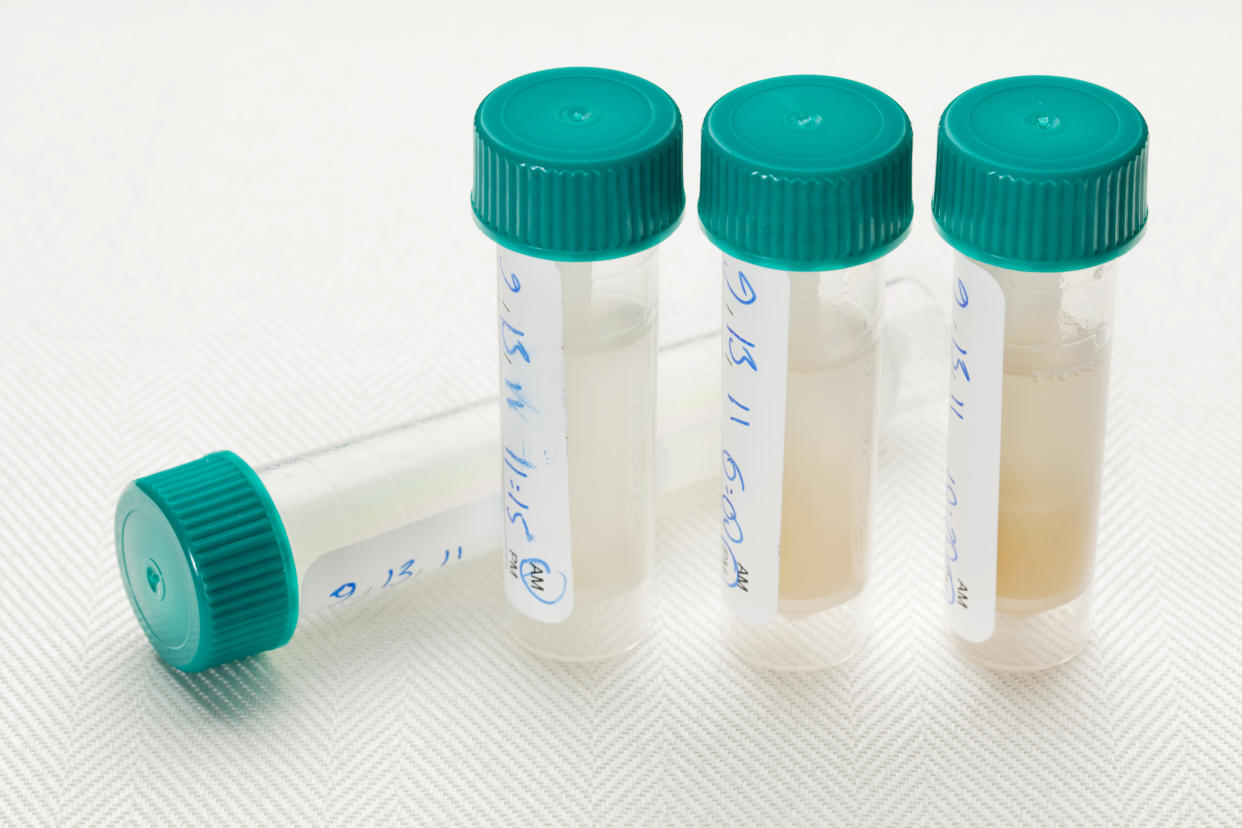 Saliva samples for laboratory test