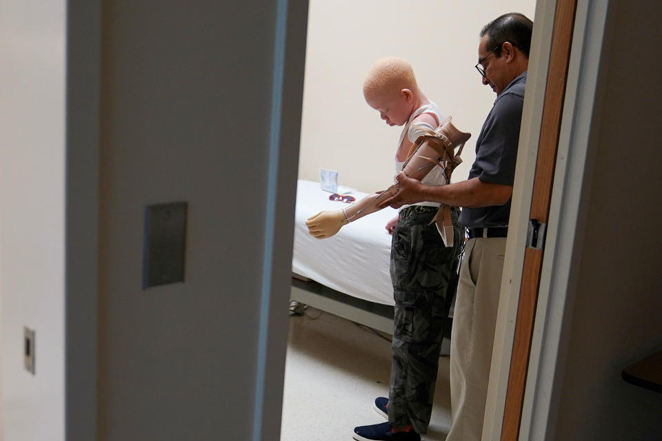 <p>Mwigulu Magesaa 14, a Tanzanian with albinism who had an arm chopped off in a witchcraft-driven attack, gets help in an examination room during a prosthetic fitting at the Shriners Hospital in Philadelphia, Pa., on May 30, 2017. (Photo: Carlo Allegri/Reuters) </p>