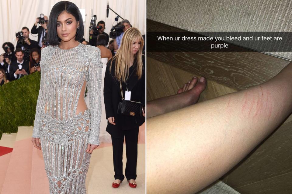 Kylie Jenner's Beading Causes Bleeding
