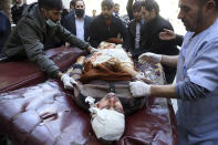 <p>People help an injured man to the hospital following a suicide attack in Kabul, Afghanistan, Thursday, Dec. 28, 2017. (Photo: Rahmat Gul/AP) </p>