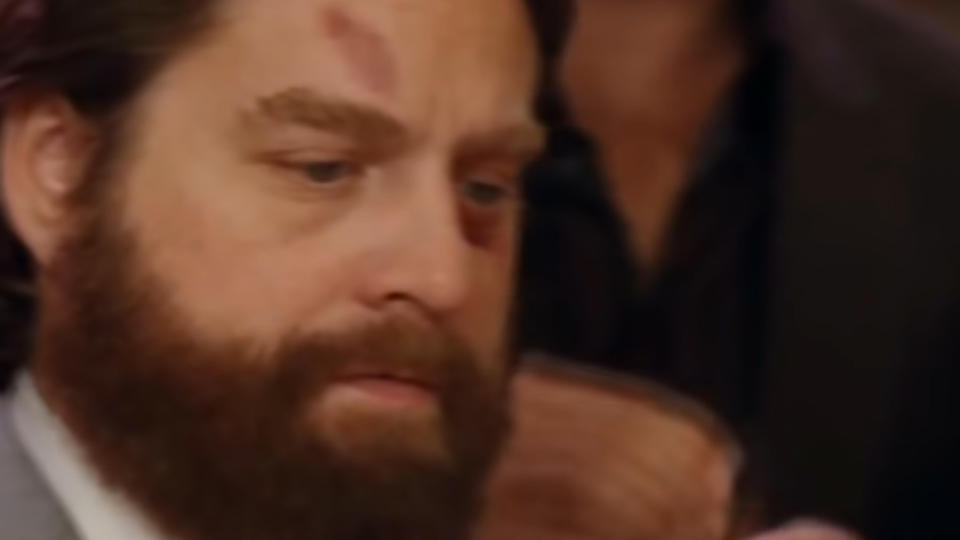 Zach Galifianakis in The Hangover