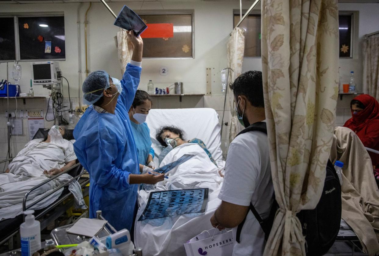 <p>Rohan Aggarwal, 26, a resident doctor treating patients suffering from the coronavirus disease (COVID-19), looks at a patient’s x-ray scan, inside the emergency room of Holy Family Hospital, during his 27-hour shift in New Delhi, India, May 1, 2021. </p> (REUTERS/Danish Siddiqui )
