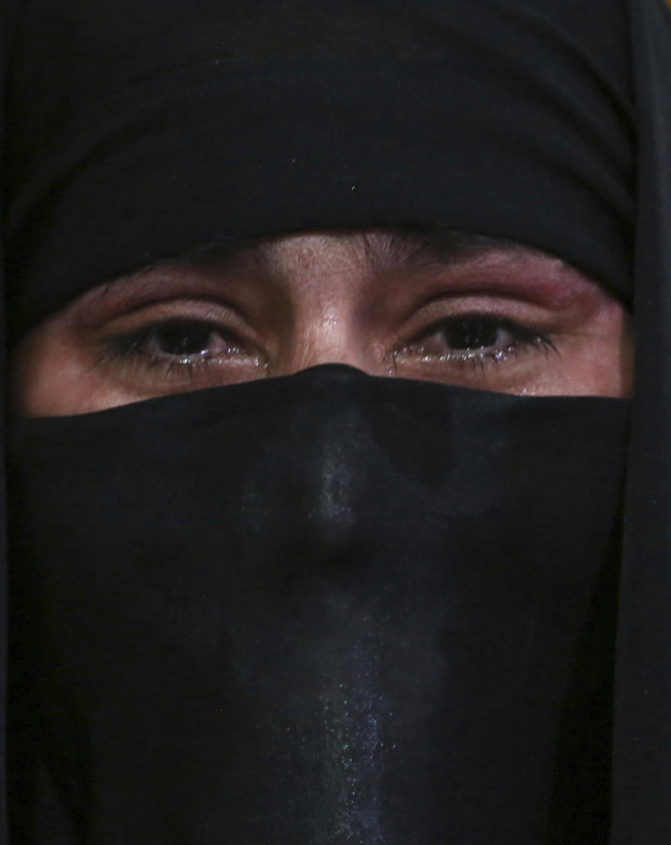 In this Monday, Feb. 18, 2019, photo, Khadeja, 18, who was burned by a pot of scalding hot water thrown by her husband, speaks during an interview with The Associated Press at a women's shelter in Herat, western of Afghanistan. The suffering of young women like Khadeja is why women rights activists say they are demanding a seat at the table in negotiations between the government and the Taliban over peace and Afghanistan’s future. (AP Photo/Rahmat Gul)