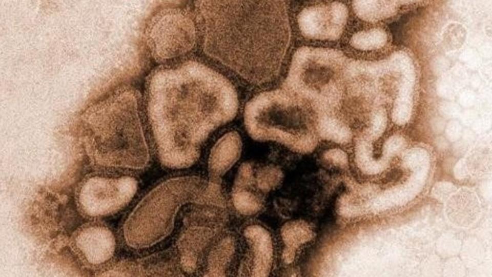 20/06/2009: 29/04/2009: Microscope view of the H1N1 influenza (flu) strain virus. Virus also known as swine flu 04 Mar 2009.