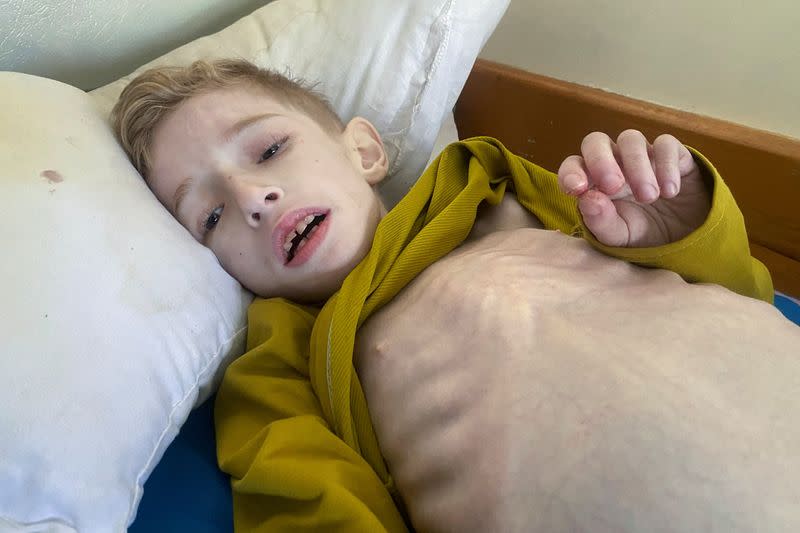El niño palestino desnutrido Fadi al-Zant yace en una cama del hospital Kamal Adwan, en medio del actual conflicto entre Israel y Hamás, en el norte de Gaza