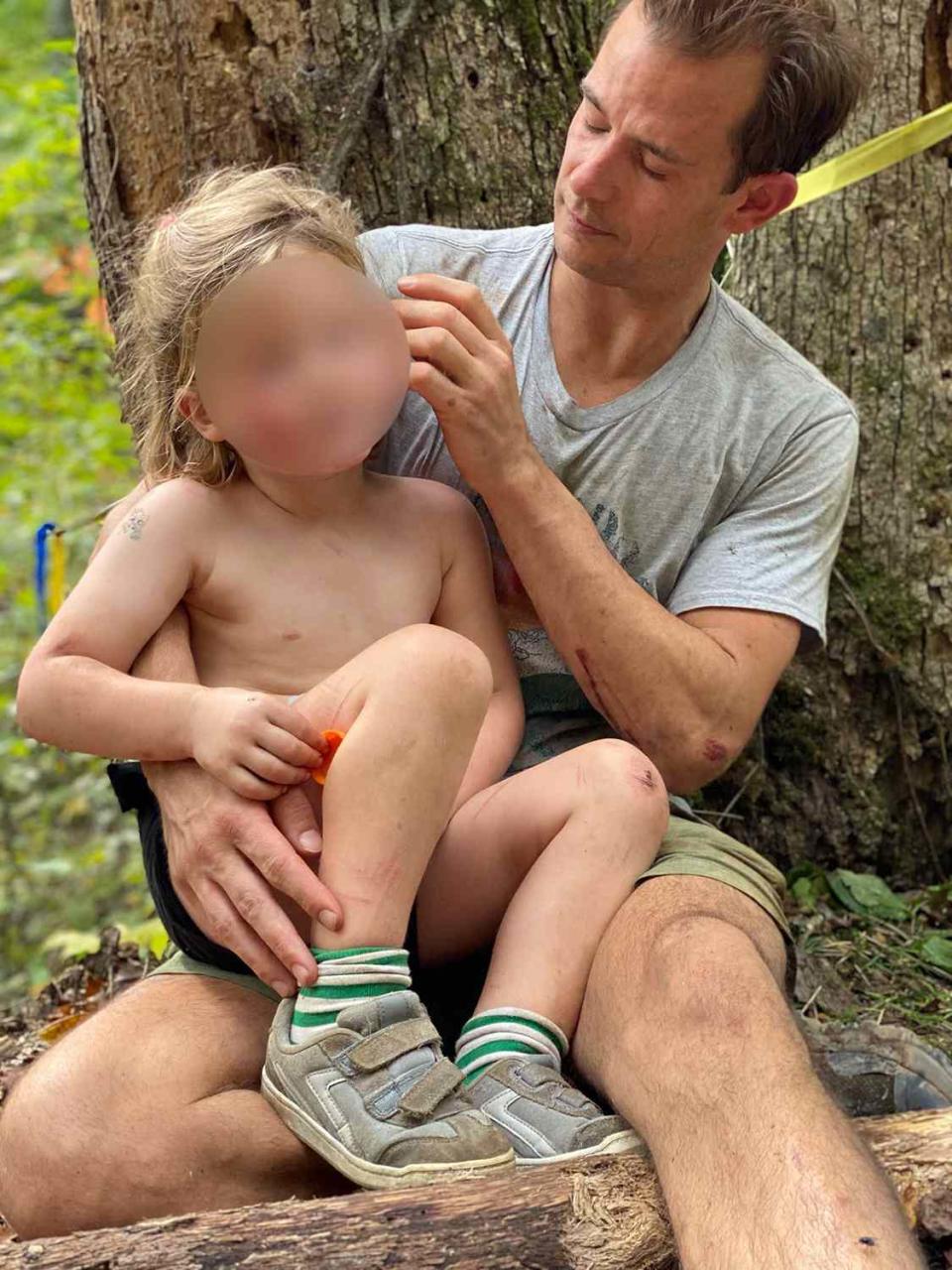 4-Year-Old 'Superhero' Boy Survives After Falling 70-Feet from Cliff During Hike with Parents