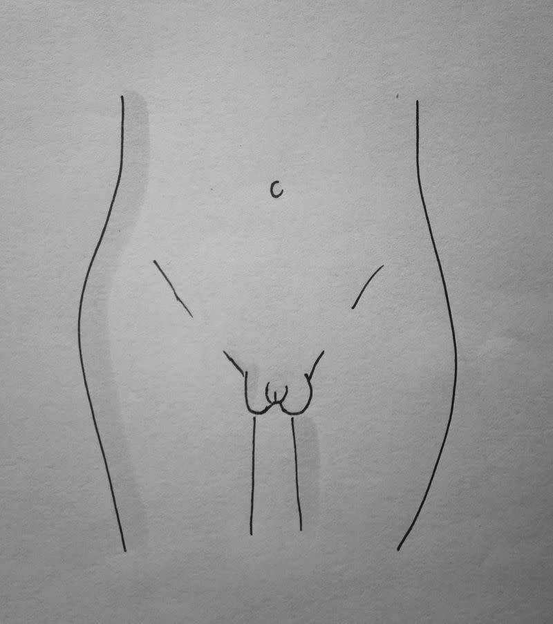 5) Types of vaginas: Prominent outer lips