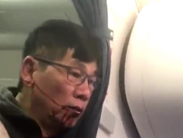 Images have emerged of the passenger bleeding heavily (Twitter)