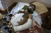 Ghassan Al-masri, 22, rests at the Shifa hospital in Gaza City, Thursday, May 13, 2021, where he is receiving treatment for wounds caused by a May 10 Israeli strike that hit a nearby his family house in town of Beit Hanoun. Just weeks ago, the Gaza Strip’s feeble health care system was struggling with a runaway surge of coronavirus cases. Now doctors across the crowded coastal enclave are trying to keep up with a very different crisis: blast and shrapnel wounds, cuts and amputations. (AP Photo/Khalil Hamra)