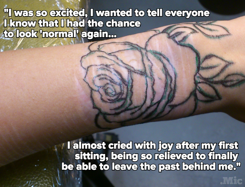 These Women Are Taking Ownership of Their Scars With Beautiful Tattoos