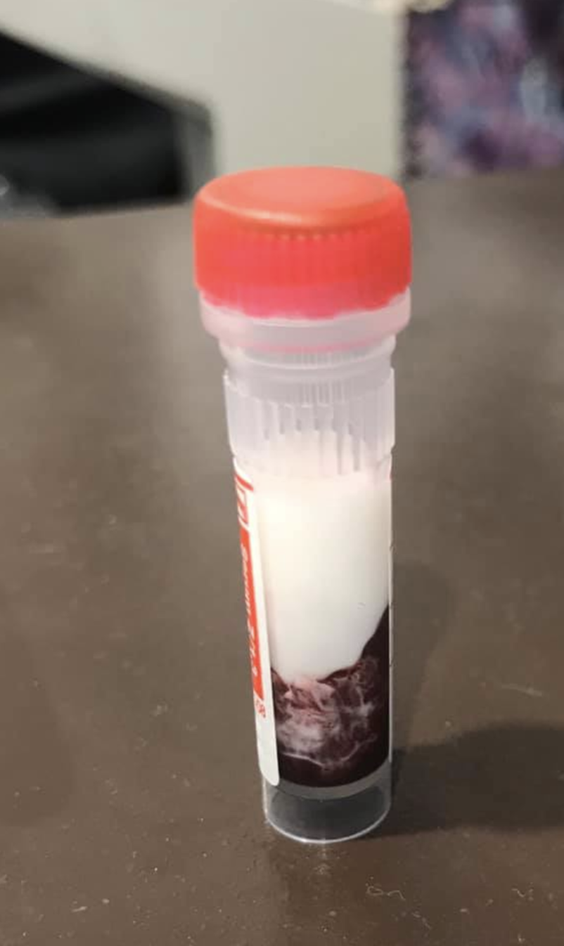 This is the spun blood of a dog that died from pancreatitis. Source: Supplied