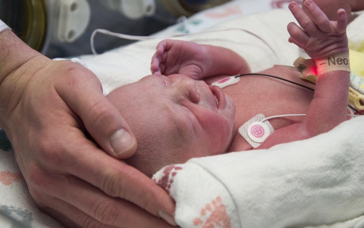 First baby born as a result of a womb transplant in the United States lies in the neonatal unit at Baylor University Medical Center in Dallas - Baylor University Medical Center