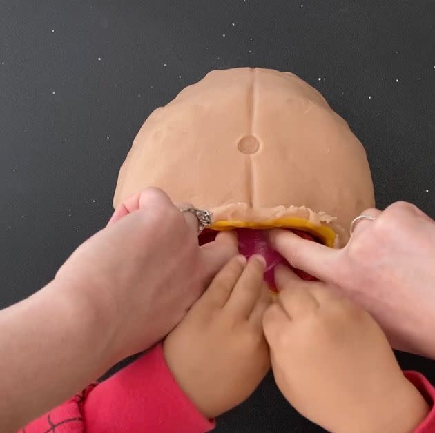 All hands on deck as Dr Jessica So and her four-year-old son conduct a play dough C-section.