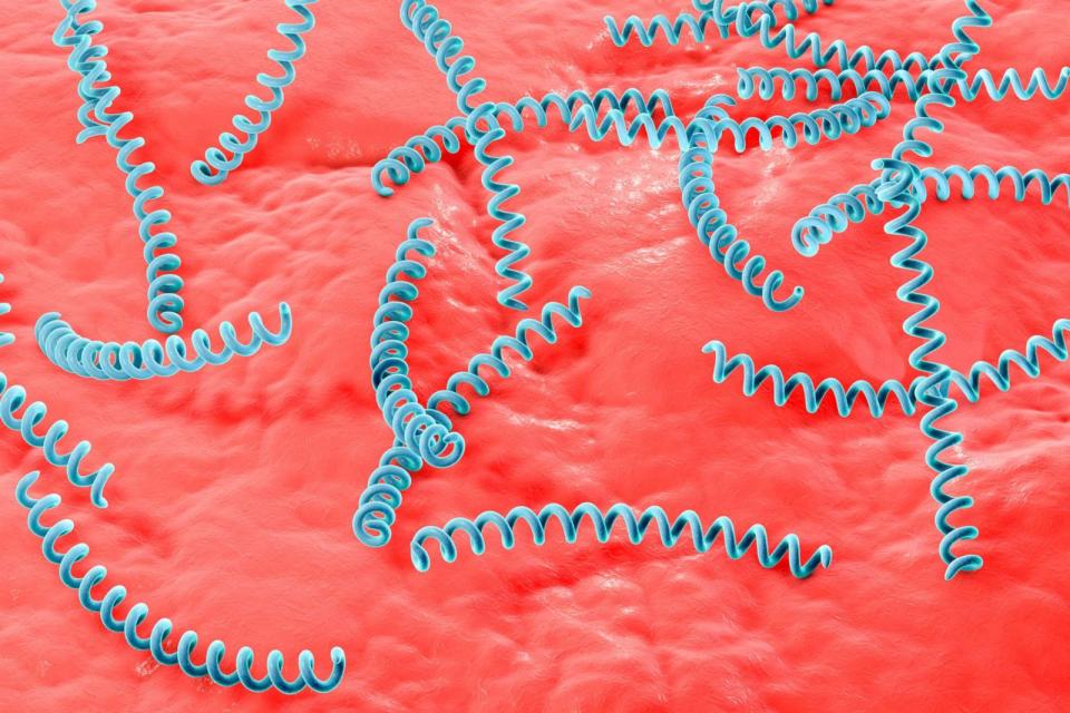 PHOTO: Computer illustration of Treponema pallidum, the bacterium which causes syphilis. (STOCK IMAGE/Getty Images)