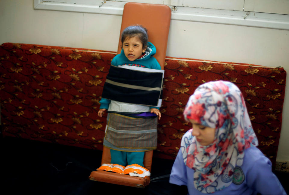 A girl attends a physiotherapy session