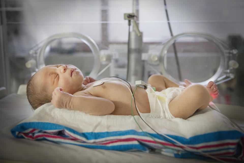 Premature baby in intensive care unit