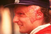 Lauda before the Italian Grand Prix at the Monza circuit in Italy. (Photo by Allsport UK/Allsport)