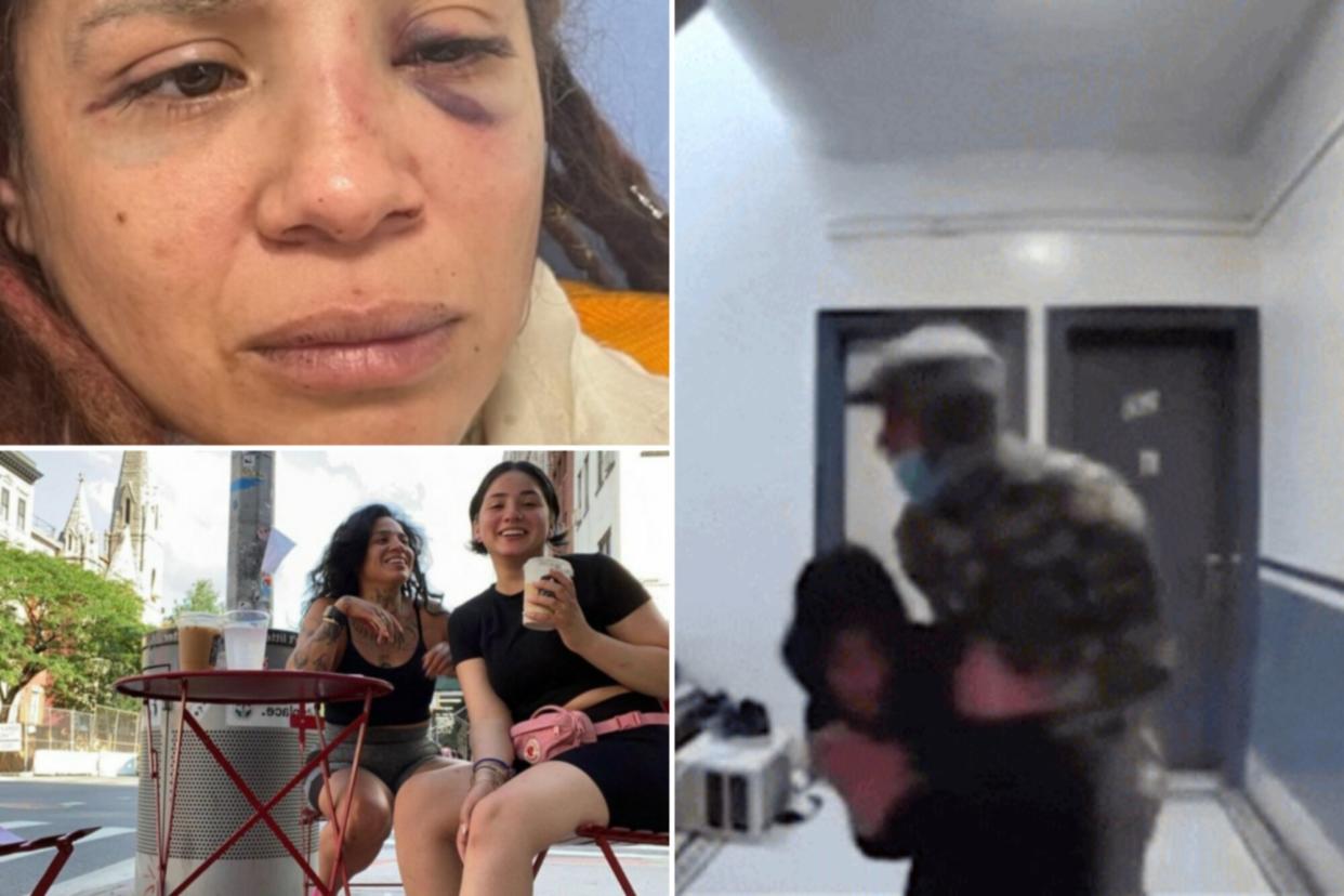 collage of woman saving her first born and her injuries