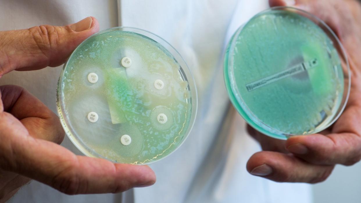 Petrischalen mit sogenannten Krankenhauskeimen, die Mehrfachresistenzen gegenüber Antibiotika aufweisen. Foto: Armin Weigel