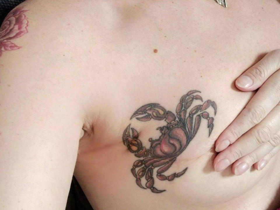 Narben-Tattoos: Wenn Zeit nicht alle Wunden heilt