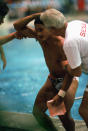 American diver Greg Louganis suffered a concussion during the preliminary rounds of the 1988 Olympics in Seoul. Although he split his head on the springboard, Louganis did qualify for the final. The diver was stitched up within an hour and returned to the platform to win the gold medal. (Getty Images)
