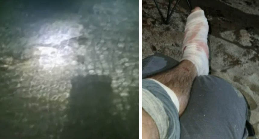 The 3 metre shark in the shallows (left) and Adam Norton's bandaged foot (right). 